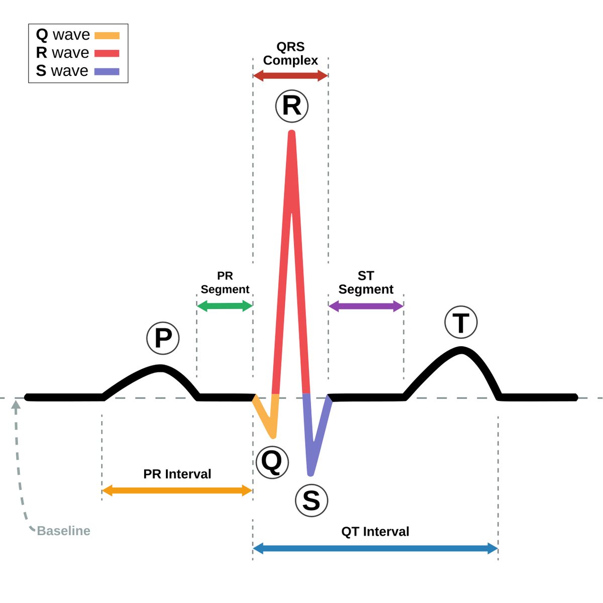 A schematic electrocardiogram trace of one normal heartbeat, with the P wave, QRS complex and T wave labelled.
